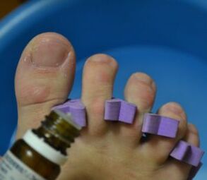 Προετοιμασία για την περιποίηση των νυχιών με αντιμυκητιακές σταγόνες